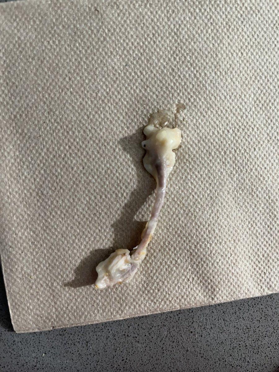 ewinkler15's tweet photo. I was trying to enjoy a Pot Pie from KFC tonight after a long day of work. While eating I bit down on something hard in my food. When spitting the food out found this big bone in my food. This is very dangerous, could have choked on this bone or broke a tooth. Disappointed @kfc https://t.co/EjNuQnw0yD