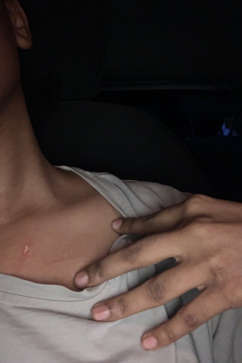 السلام عليكم يا جماعة الليلة في شارع الستين مع البلابل حصلت مناوشة بينا انا و ست العربية دي و لما نزلت اعتدت علي و معاها مجموعة بنات بي صوت عنج و الايدي.. 

و ما عندي كلام اكتر من دا