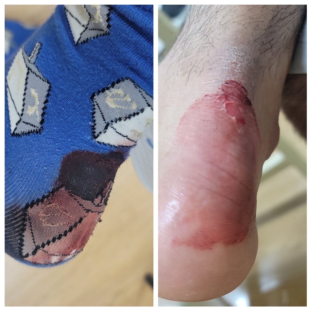 You wanna know how far I'm willing to go? I'll never know cuz I keep finding new territory!

For my daughter Sorin...every step is for you that you can't take...! 

<a href="/davidgoggins/">David Goggins</a> #crossfit #nevergiveup #justdoit #keepgoing💪 #badhand #canthurtme  #the40percentrule #크로스핏