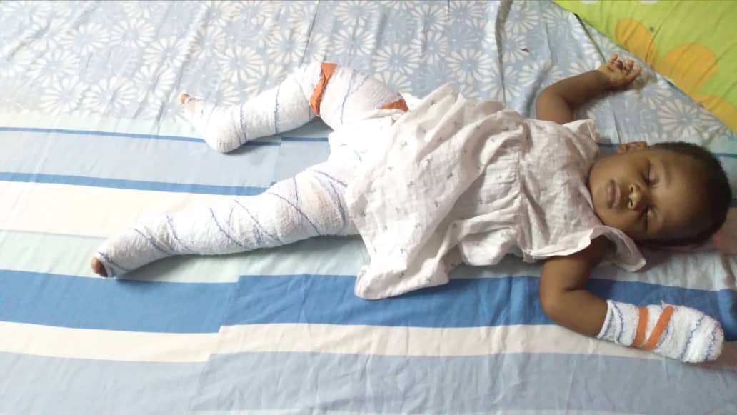 HialineW's tweet photo. @tammyforla S'il vous plaît Quelqu'un peut-il m'aider à payer mes frais d'hospitalisation? S'il vous plait j'en ai vraiment besoin. L'eau chaude tombe sur elle et la douleur EST trop forte pour elle. J'ai besoin d'aide s'il vous plait https://t.co/wWFeiDPhmT