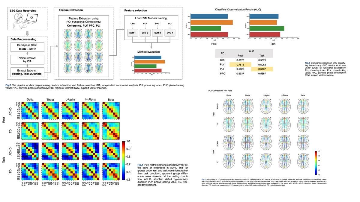 PCN_Psychiatry's tweet photo. Atypical functional connectivity during rest and task-related dynamic alteration in young children with attention deficit hyperactivity disorder: An analysis using the phase-locking value
#ADHD #electroencephalography #EEG #functional_connectivity #phase_locking_value #SVM https://t.co/0IMR4PhM7c