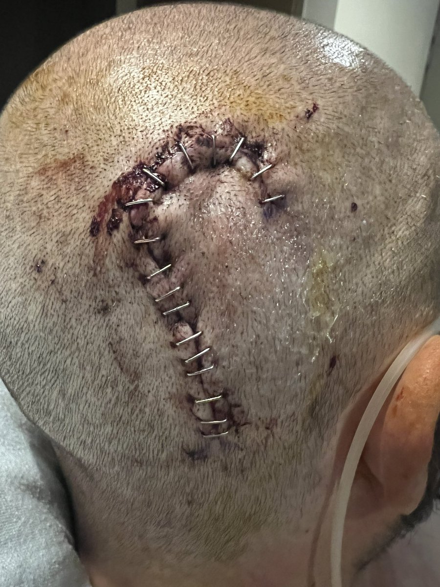 BG (Bryant Garvin) tweet media