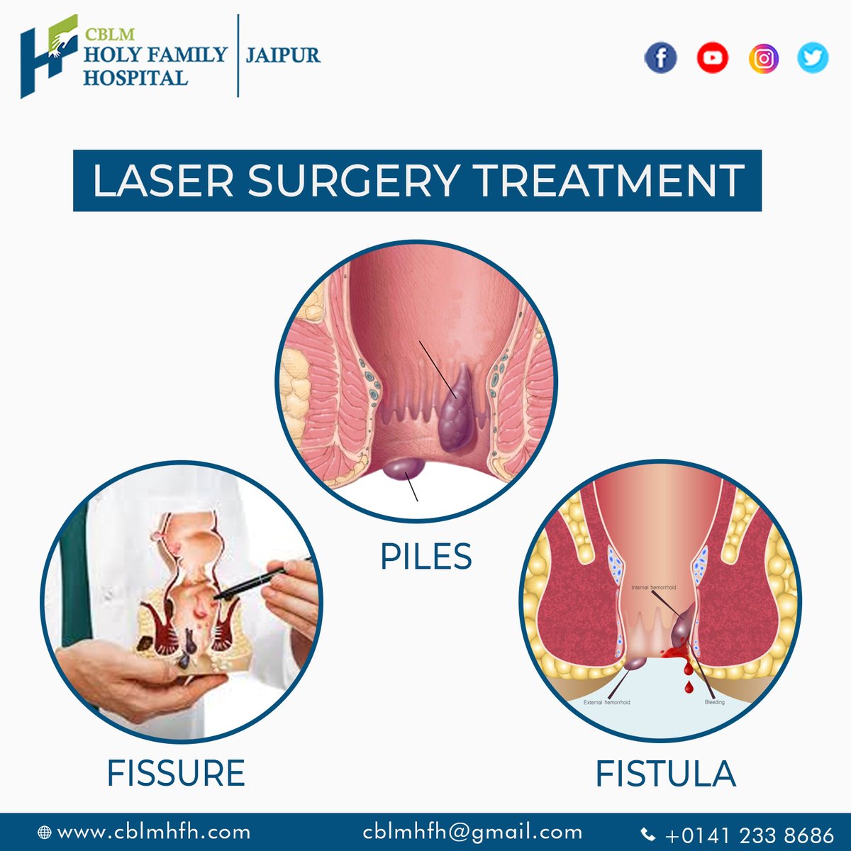 CBLMHFH's tweet photo. Get the piles treatment in Jaipur, #CBLM #HolyFamilyHospital offers the best piles treatment in Jaipur to be healthier and better relieves from piles.
Book your appointment now.
For more information,
Visit: - https://t.co/3Bzg9YWrbU
#analpain #internalhemorrhoids https://t.co/Yz43vhwrlX
