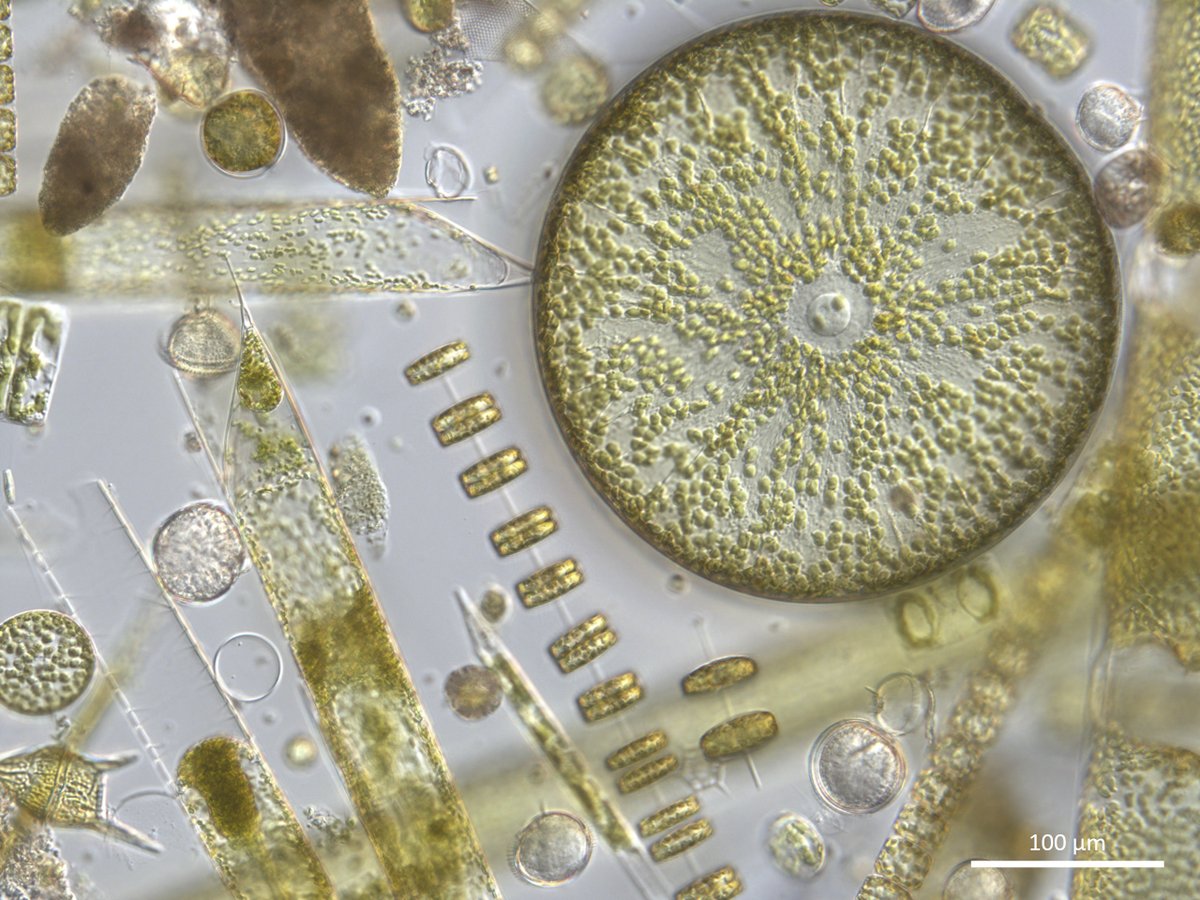 Claire_plankton's tweet photo. Oh hello! So many beautiful #phytoplankton species blooming at #StationL4 #westernchannelobservatory right now @PlymouthMarine 🔬 https://t.co/ixszWIp7sF
