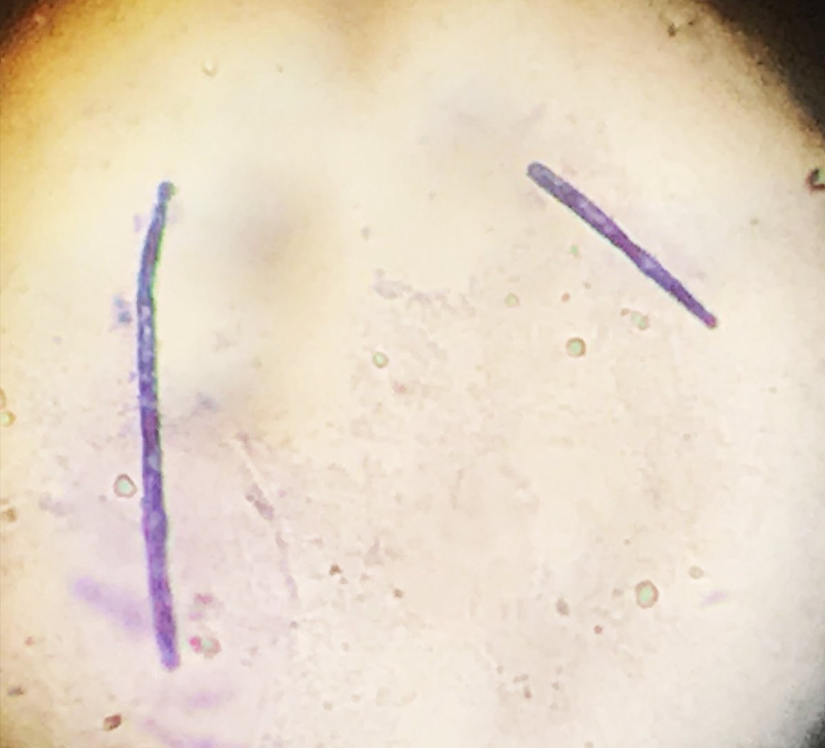 Análisis de Heces en aves.🔬🧫🐦
Hoy es miércoles de microscopio y tinciones en #IBEROGEN. ¿Os animáis a escribir en los comentarios qué es cada imagen?🔍

Visita nuestra web para más información o contacta directamente por teléfono o Whatsapp.

Un saludo y buena cría!🐣