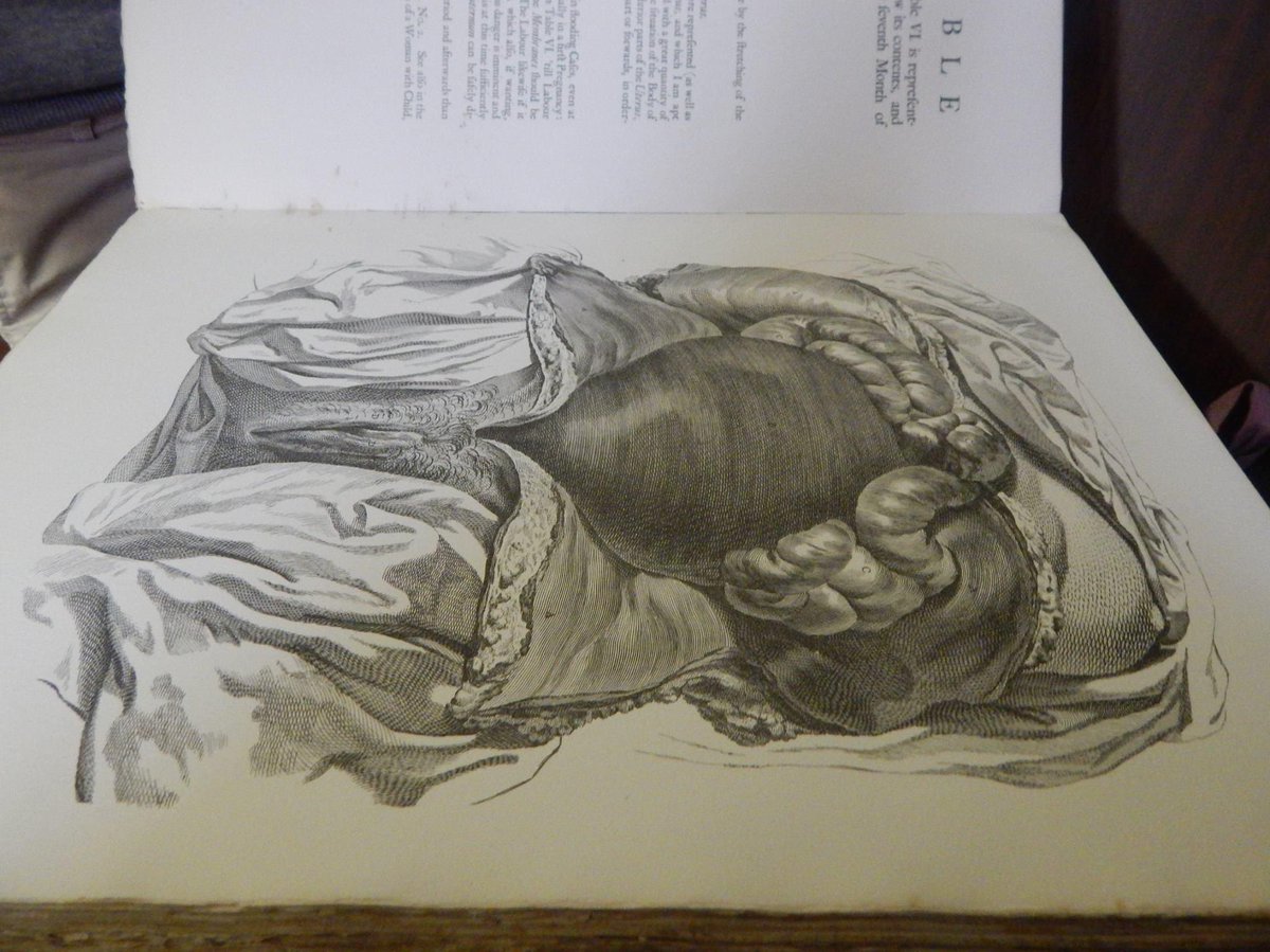 IMSS_Chicago's tweet photo. Pictured here is an illustration of the vagina, uterus, and intestine from “Anatomical Tables with Explanations and the Abridgment of the Practice of Midwifery,” published in London in 1761 by Dr. William Smellie. He is known as the Father of British Midwifery. #imsschicago https://t.co/JqPD4EEJFq