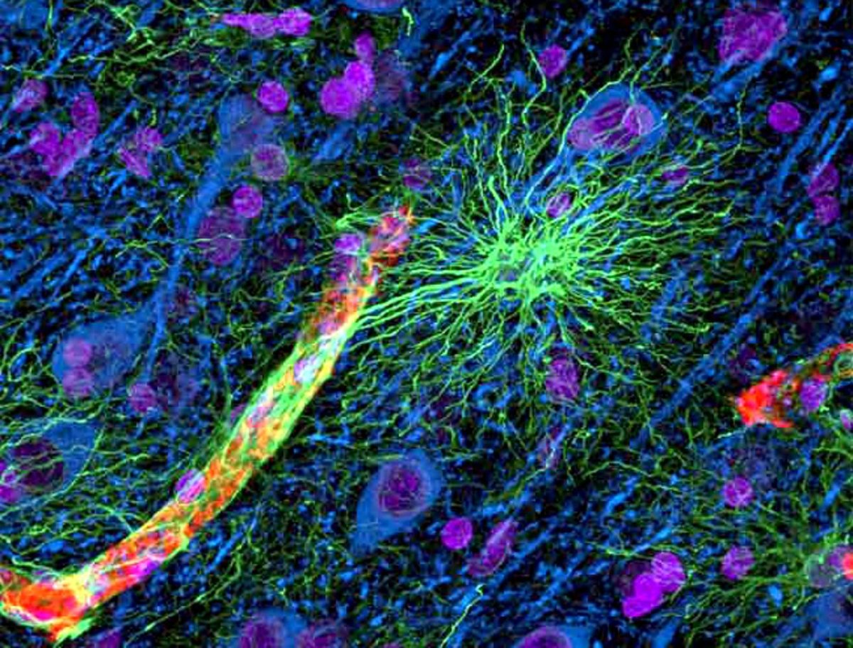 An astrocyte (green) reaching out to a blood vessel (yellow and red). The neurons (blue) are not in direct contact with the vessel and rely on astrocytes for the transport of nutrients of waste.

#Neuroscience #NeuroTwitter #Bioinformatics #Science 

Credit: Maiken Nedergaard
