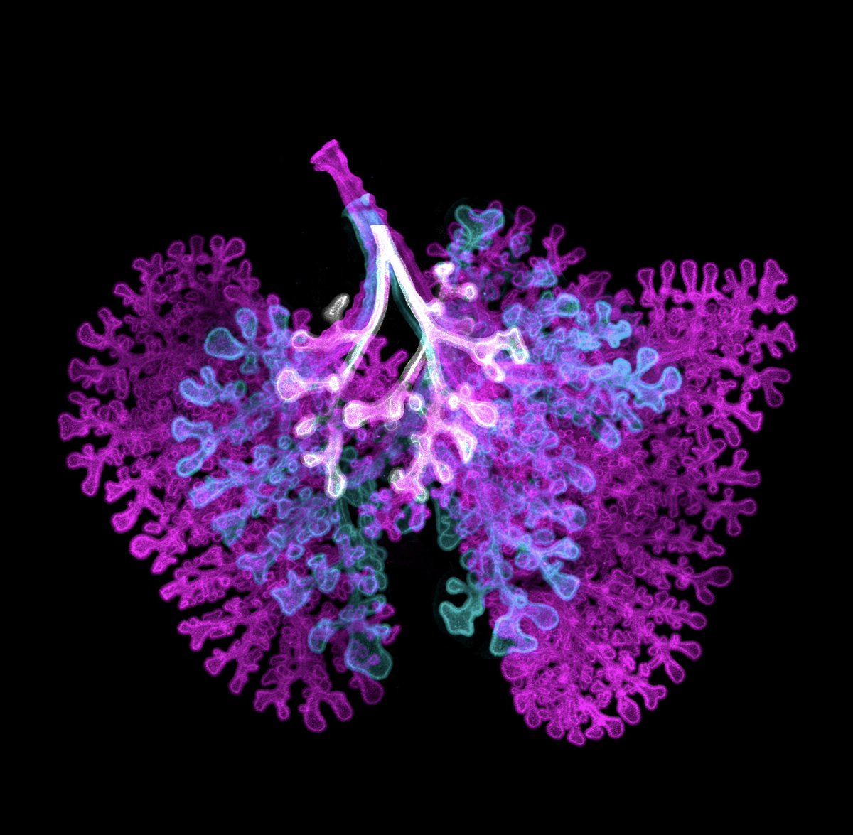 Sarah Paramore, PhD (@parahsaramore) on Twitter photo Decided to submit for <a href="/NikonSmallWorld/">Nikon Small World</a> - sequential days of branching morphogenesis in the mouse lung 🫁 (e12.5-14.5 ecad stained lungs) all lungs to scale - pretty amazing how rapidly branching occurs 🤗 Decided to submit for <a href="/NikonSmallWorld/">Nikon Small World</a> - sequential days of branching morphogenesis in the mouse lung 🫁 (e12.5-14.5 ecad stained lungs) all lungs to scale - pretty amazing how rapidly branching occurs 🤗