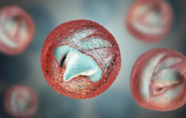 IrishSunOnline's tweet photo. Urgent health warning after Irish parasitic outbreak – the seven symptoms to watch for https://t.co/nUh3Ux3W0e https://t.co/00n5kiQtGD
