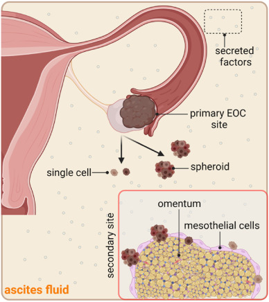 The Dawson Lab (@cellbiophysics) on Twitter photo New #ovariancancer #exosome review from my lab. Congrats to Amy Lee and Ivy Koh! <a href="/DawsonStemCell/">Michelle R Dawson</a> <a href="/CellBiophysics/">The Dawson Lab</a> <a href="/Brown_BME/">Brown University Center for Biomedical Engineering</a>
sciencedirect.com/science/articl… New #ovariancancer #exosome review from my lab. Congrats to Amy Lee and Ivy Koh! <a href="/DawsonStemCell/">Michelle R Dawson</a> <a href="/CellBiophysics/">The Dawson Lab</a> <a href="/Brown_BME/">Brown University Center for Biomedical Engineering</a>
sciencedirect.com/science/articl…