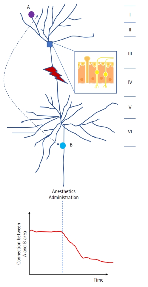 Korean_J_Anesth's tweet photo. [Review] How general anesthetics work: from the perspective of reorganized connections within the brain
https://t.co/8S3KxPdYSU
#Anesthetics #Consciousness #DeepSedation #GeneralAnesthesia #Hypnotics #sedatives #Unconsciousness https://t.co/GXqSxWXaKG
