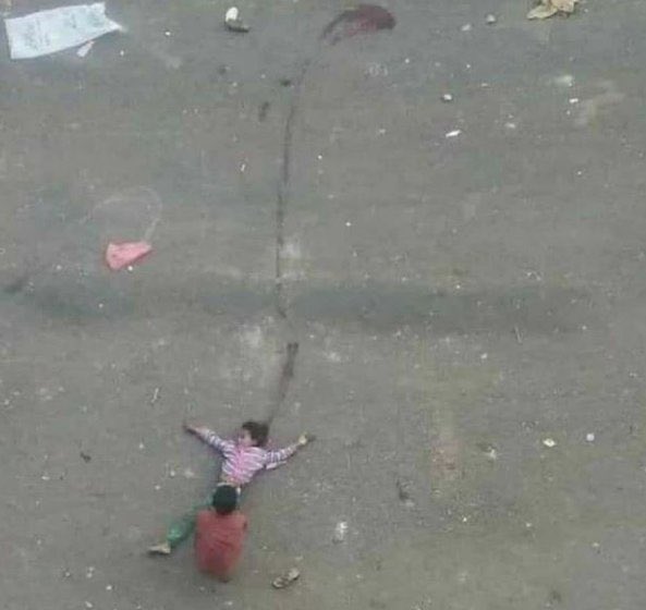 JhonnyNicaragua's tweet photo. Una imagen dolorosa de una niña yemení siendo atacada por un francotirador saudita mientras traía agua a casa y su hermano arrastrando el cuerpo sin vida de su hermana a casa. ¿Donde estan las naciones unidas? ¿Solo tienes que ser rubia y tener ojos azules? https://t.co/Z2ione5kNf