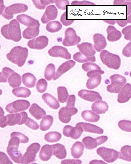 HistologyHome's tweet photo. Hematology/Immune System Histology: Tweetorial #2

Topic: Histology of Erythrocytes and Platelets

Pop Quiz (poll in next tweet): What is the normal 3D shape of erythrocytes?

#HistoHQ

1/13 https://t.co/tI6e0AAiFq