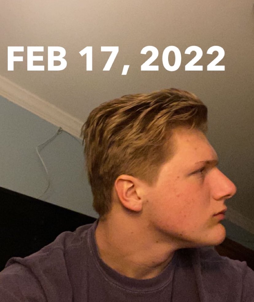 BigBroInfo_'s tweet photo. How I cleared my skin in just 5 months:                                    THREAD//🧵 https://t.co/SVCwGajb8q