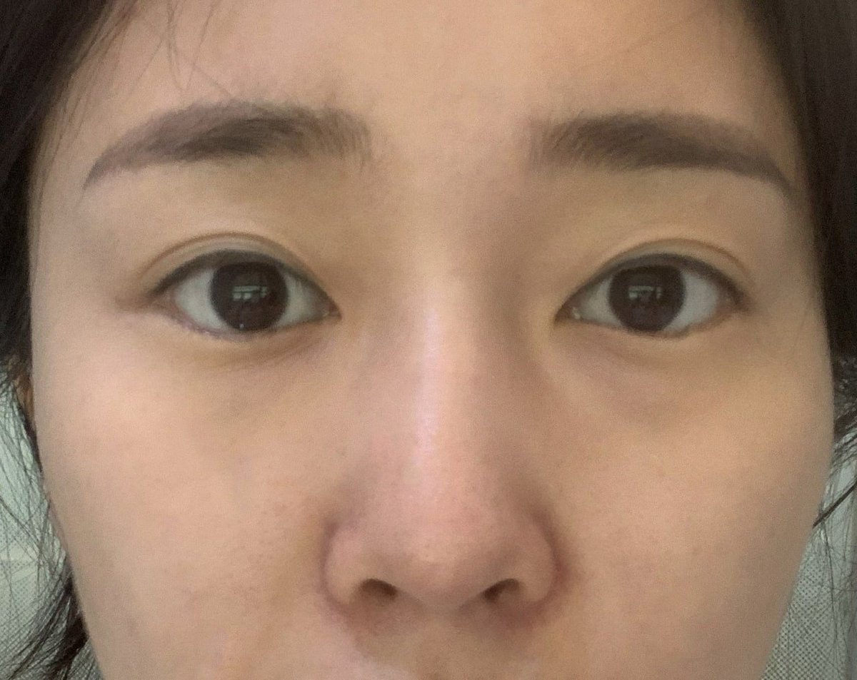 団子鼻のtwitterリアルタイム検索結果 Meyou ミーユー