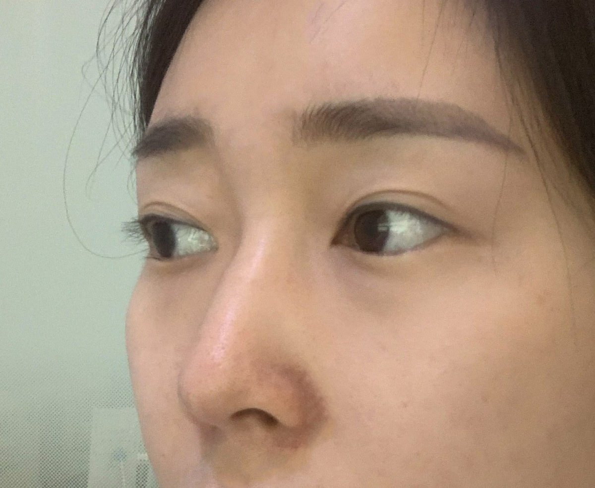 団子鼻のtwitterリアルタイム検索結果 Meyou ミーユー