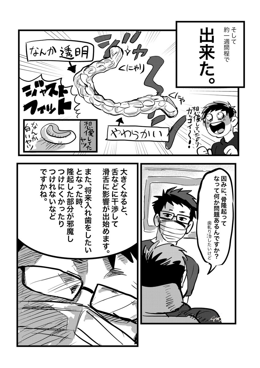 歯医者でマウスピース作ってきた話 