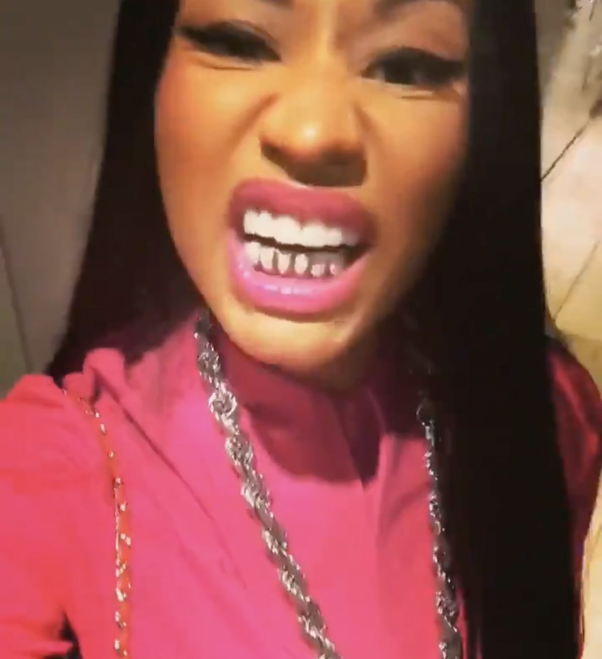 Nicki minaj teeth online