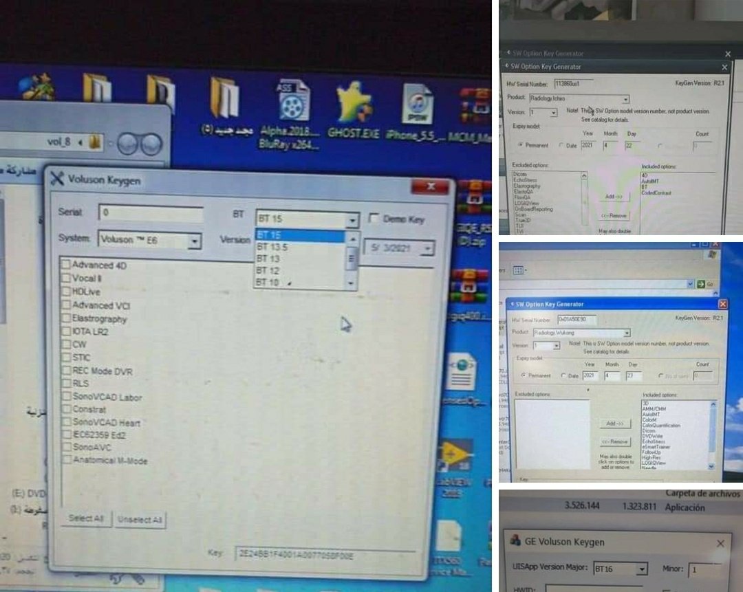 More72561385's tweet photo. We have all the active ultrasound Generator and options at very affordable prices.
#ge
#Key_option
#software
#ultrasound
#BME
#Service https://t.co/GXDJNLAeKg