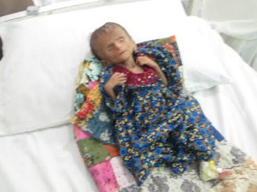 Zara_Baloch26's tweet photo. بلوچستان میں صحت اور سماجی شعبے کی صورتحال سوڈان اور صومالیہ سے بھی بدتر ہے
#WorldHealthDay 
#BalochHealthMatters https://t.co/Xb9oGE4UX0