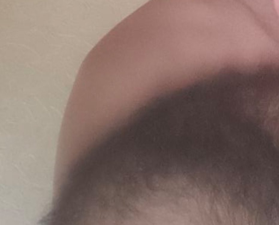 Вот моё плечо , вот твоё плечо . Вот такой контраст между белой и хачём.