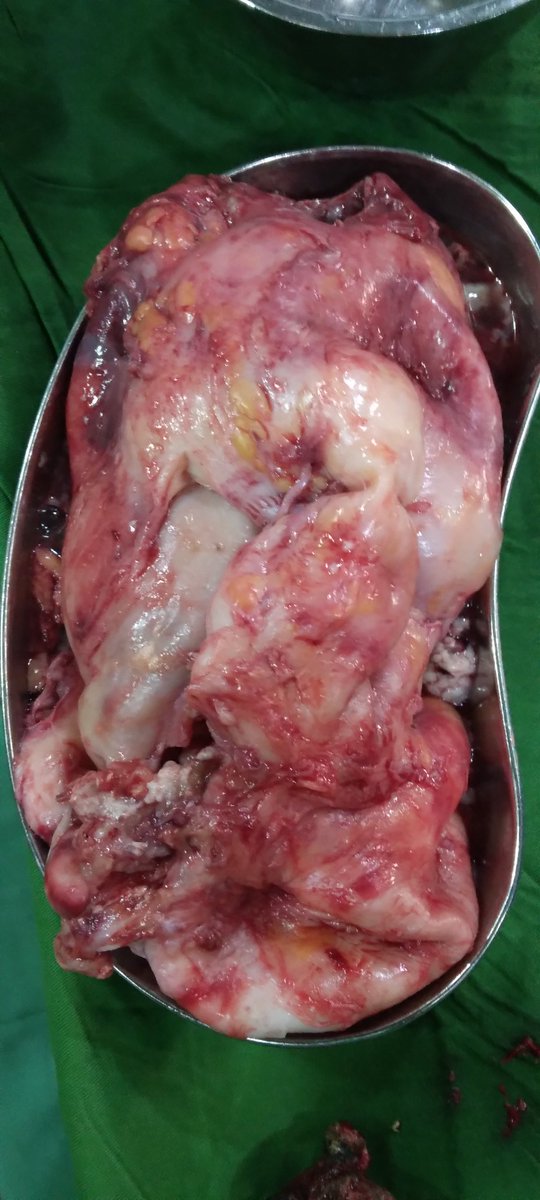 Bismillaah
Bbrp warga tweetland DM sy nanya apa bahaya kalau batu ginjal dibiarkan.. 
Ini jawabannya...