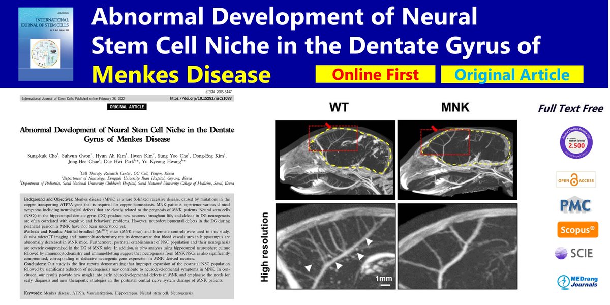 IntJStemCells's tweet photo. Abnormal Development of Neural Stem Cell Niche in the Dentate Gyrus of #Menkes_Disease
open access🌷https://t.co/1uyq8N4g8w
International Journal of Stem Cells 2022 online first, Dae Hwi Park, Yu Kyeong Hwang
#Hippocampus #Neural_stem_cell #Neurogenesis https://t.co/CLOGcZkSJN