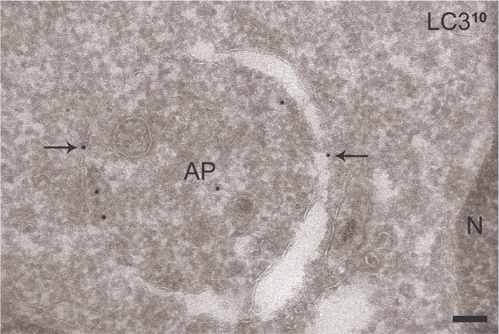JA_Beek's tweet photo. Just out, a new toolbox article from Ann De Mazière, me and others from the @JKlumperman lab! In this paper in Autophagy, we describe an optimized method for labeling LC3 in Electron Microscopy. A valuable tool for all researchers in #autophagy!
https://t.co/Ok4srzlg14 https://t.co/IsTFftfl0U
