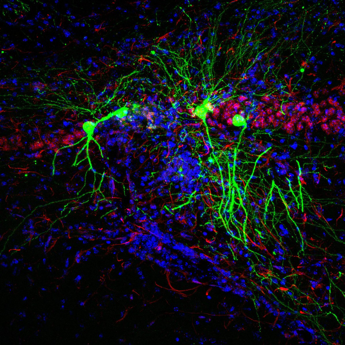 chrost_hugo's tweet image. Hippocampal neurons of mice injected with the Toxoplasma protein (green). Other neurons and cell nuclei shown in red and blue, respectively. 

#neuroscience #NeuroTwitter #science #brain #Bioinformatics #Biology #medicine 

Credit: Mendez et al.