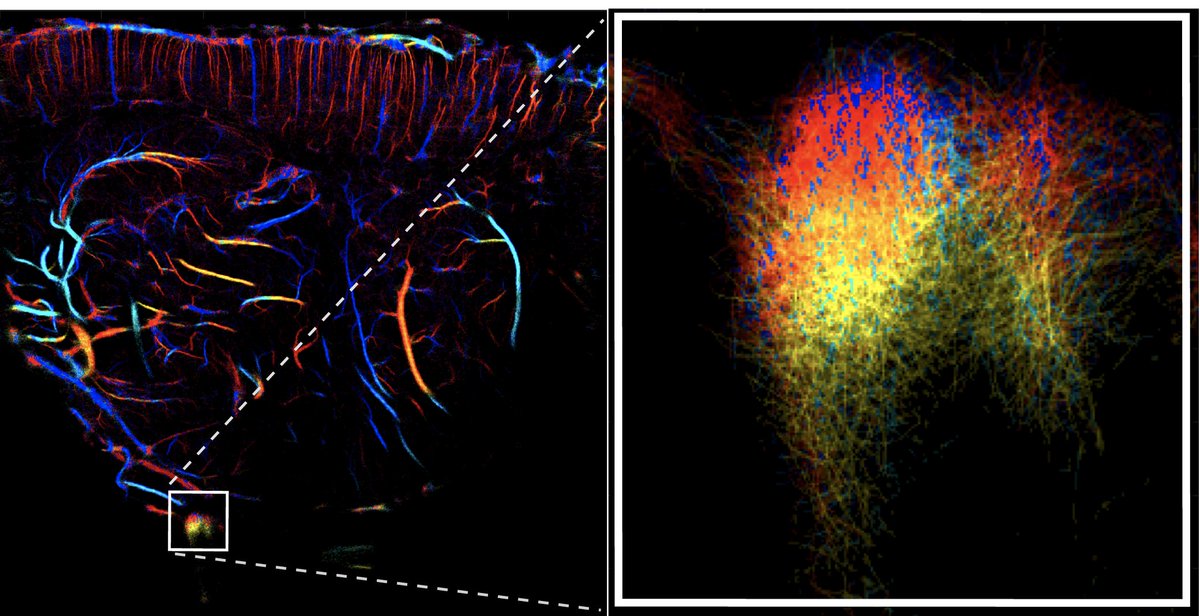 PezetSophie's tweet photo. Our last study is out today @CommsBio
https://t.co/pt0p6H1qxu
Fruitful collaborative work with A. Reaux  @InstVisionParis, #TanterM, @DeffieuxThomas at @Physmed, @ESPCI, @iconeus. We reveal specific features of the trigeminal ganglion, a key structure in trigeminal pain. 1/2 https://t.co/39lpWE3nLt