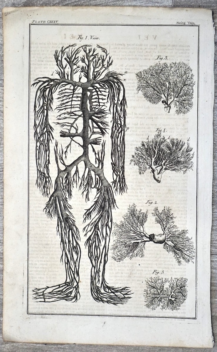MBlindflowers's tweet image. antichecuriosita.co.uk/product/antiqu…

Antique Engraving Print, Blood-system, Vein, 1739 ca. 22.3 x 35.5 cm.

#print #engraving #bloodsystem #antiques #antiquarian #stampe #anatomy #anatomia #vein #veins #medical