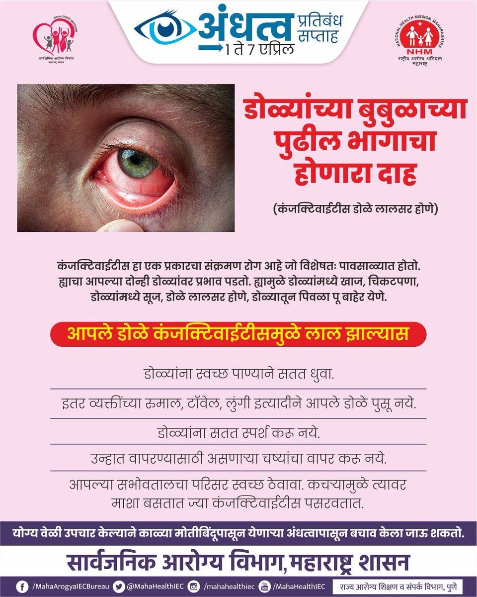 InfoNandurbar's tweet photo. नयन कमल तेजोमय
दिसे सृष्टी निरामय
डोळ्यांचे आरोग्यभान जपूया l
आपली दृष्टी निकोप राखूया ll
@MoHFW_INDIA @AyushmanNHA @moayush
#PreventionofBlindnessWeek #Cataracts #awareness #BlindnessWeek #EyeCare #FitMaharashtra @N7NewsNandurbar https://t.co/fpPWkhVgcT