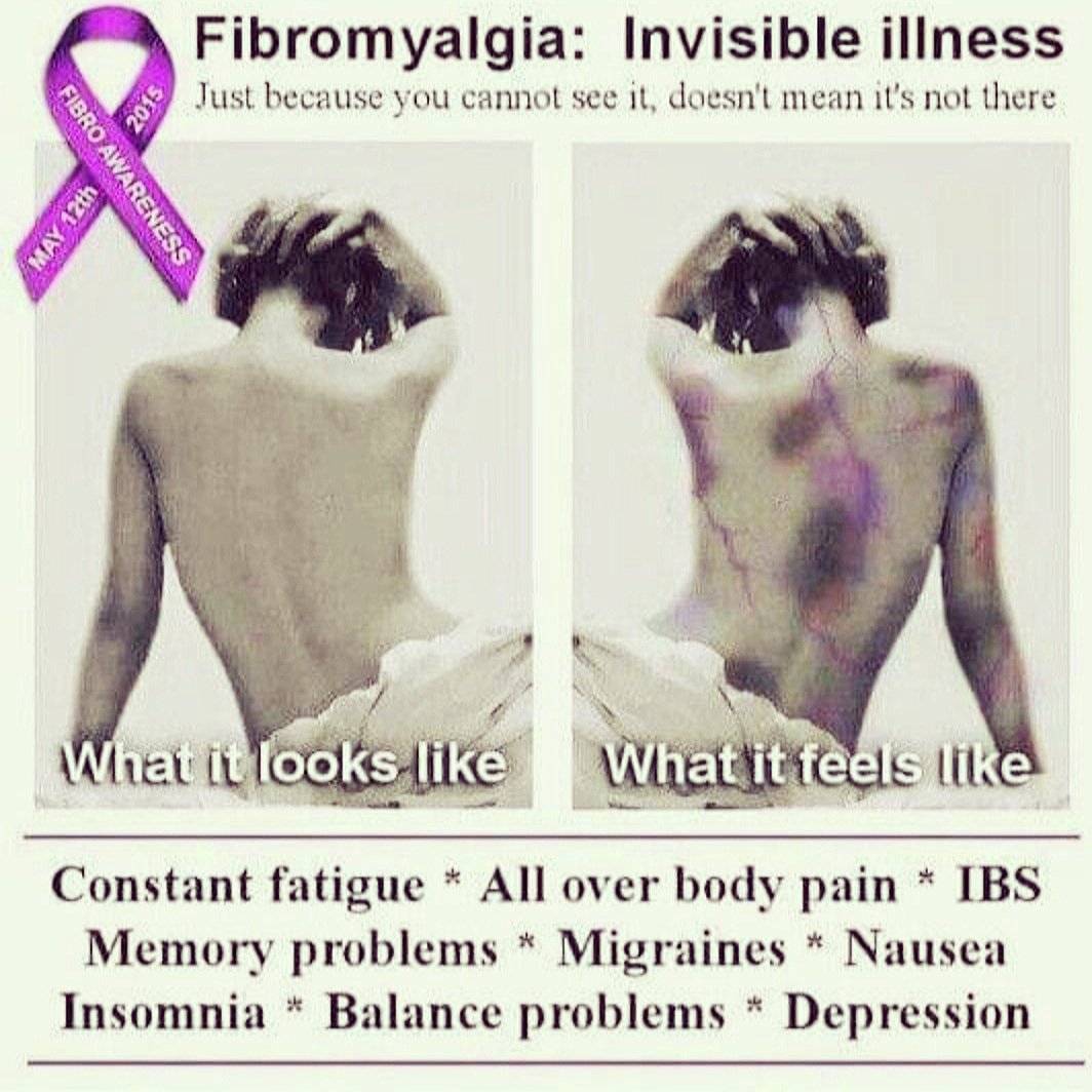 What it looks like, what it feels like...#fatigue #widespreadpain #IBS #memoryissues #migraines #nausea #insomnia #balanceproblems #depression #somanyissues #fibromyalgia #cfs #fibromyalgiasupport