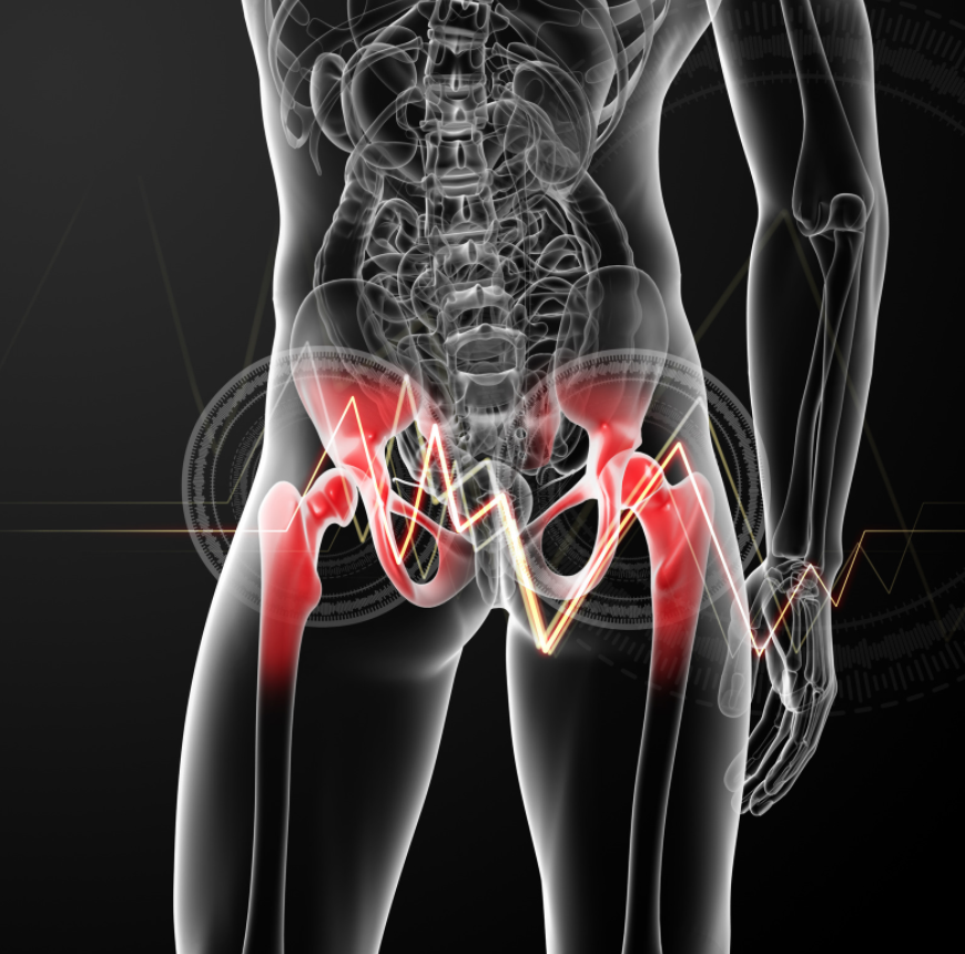 DrJeffPadalecki's tweet photo. What is #PsoasImpingement?
Aka Internal #SnappingHipSyndrome, occurs when the iliopsoas tendon, located on the front of the hip joint, becomes inflamed and tight due to repeated abnormal motion of the hip. This motion causes the ITB band to snap across...https://t.co/HGNAO4kjQN https://t.co/KVo22M0pRP