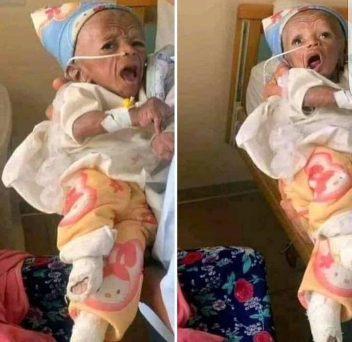 በርሃብ እየረገፉ ካሉት ከትግራይ ህዝብና ህፃናቶች ጎን እንቁም! የሰው ልጅ በረሃብ አይሙት! ልጆች አይለቁ!!