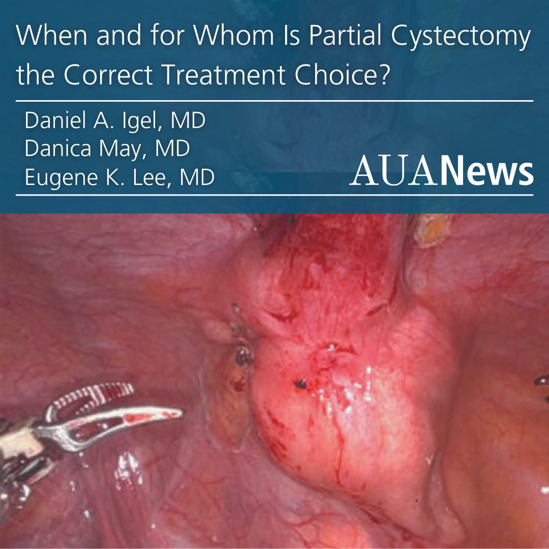 AmerUrological's tweet photo. When and for Whom Is Partial Cystectomy the Correct Treatment Choice? Read this #AUANews Article - by Drs.@daniel_igel, Danica May, and @eugenekanglee - to find out!⚛️ #UroSoMe

Full Article Here➡️https://t.co/nROD3BgeWA https://t.co/9liJFShQAP