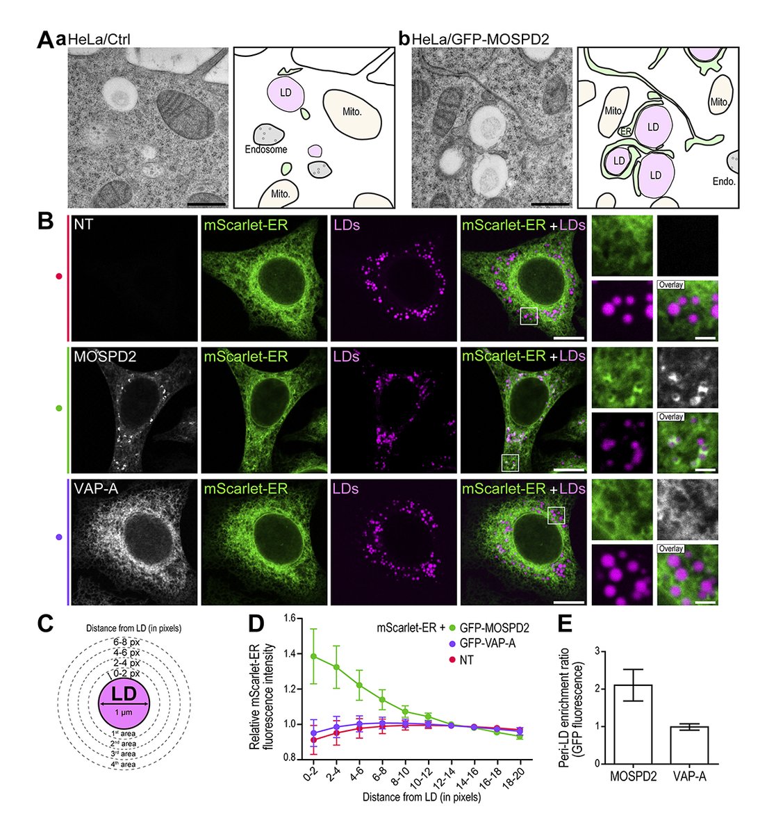 Rockefeller U. Press (@rockupress) on Twitter photo In <a href="/JCellBiol/">Journal of Cell Biology</a>, Zouiouich, <a href="/AlpyFabien/">Fabien ALPY</a> <a href="/CTomasetto/">Catherine Tomasetto</a> et al. report that the MOSPD2 protein holds a second tethering activity that builds contacts between the ER & lipid droplets and contributes to the biology of #LipidDroplets. bit.ly/3ui9EDr
#Organelles #ER_literature In <a href="/JCellBiol/">Journal of Cell Biology</a>, Zouiouich, <a href="/AlpyFabien/">Fabien ALPY</a> <a href="/CTomasetto/">Catherine Tomasetto</a> et al. report that the MOSPD2 protein holds a second tethering activity that builds contacts between the ER & lipid droplets and contributes to the biology of #LipidDroplets. bit.ly/3ui9EDr
#Organelles #ER_literature