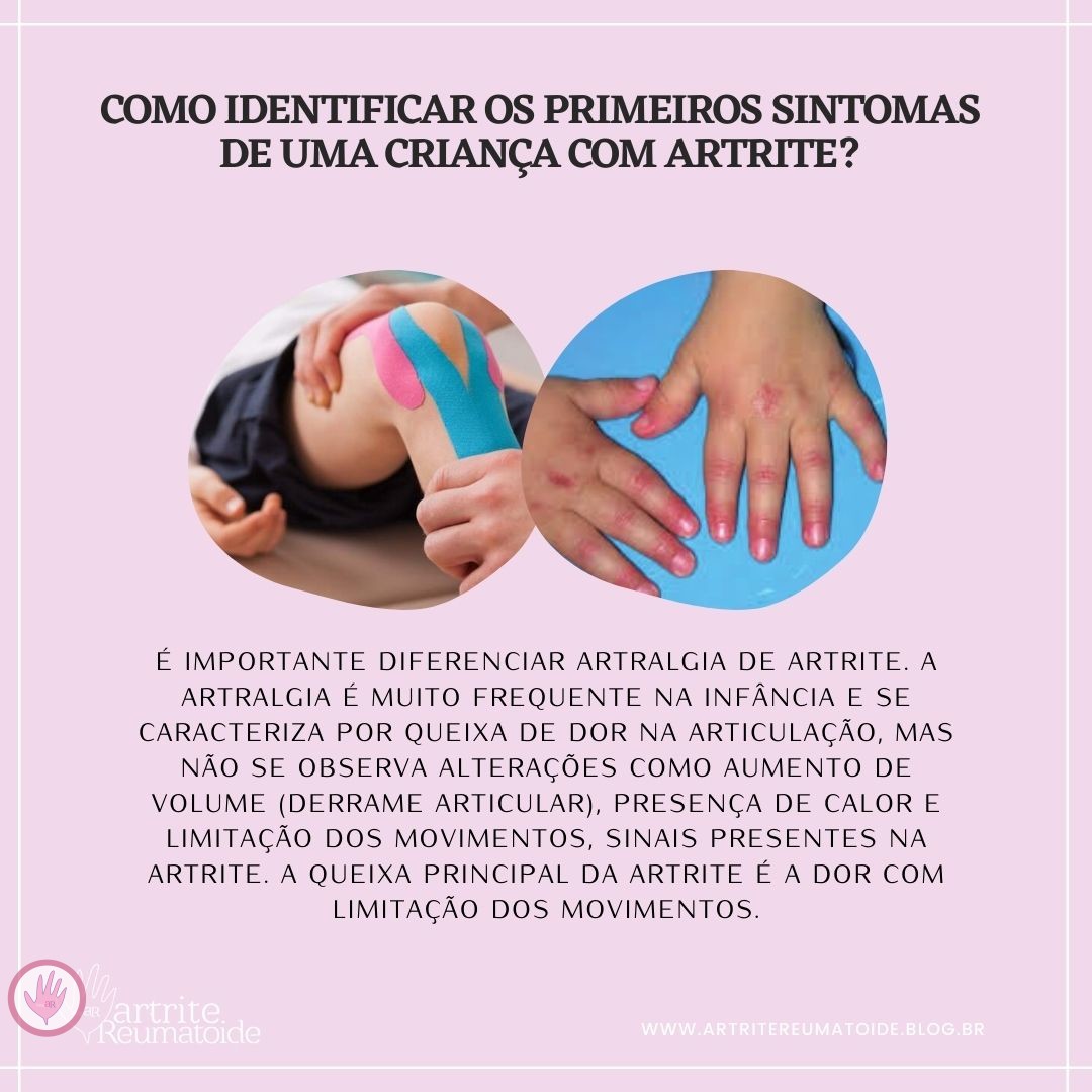 pryscilatorres's tweet photo. Como identificar os primeiros sintomas de uma criança com artrite?
Saiba mais em #blogAR https://t.co/fox945CU5N https://t.co/XVsuAfmZ3y