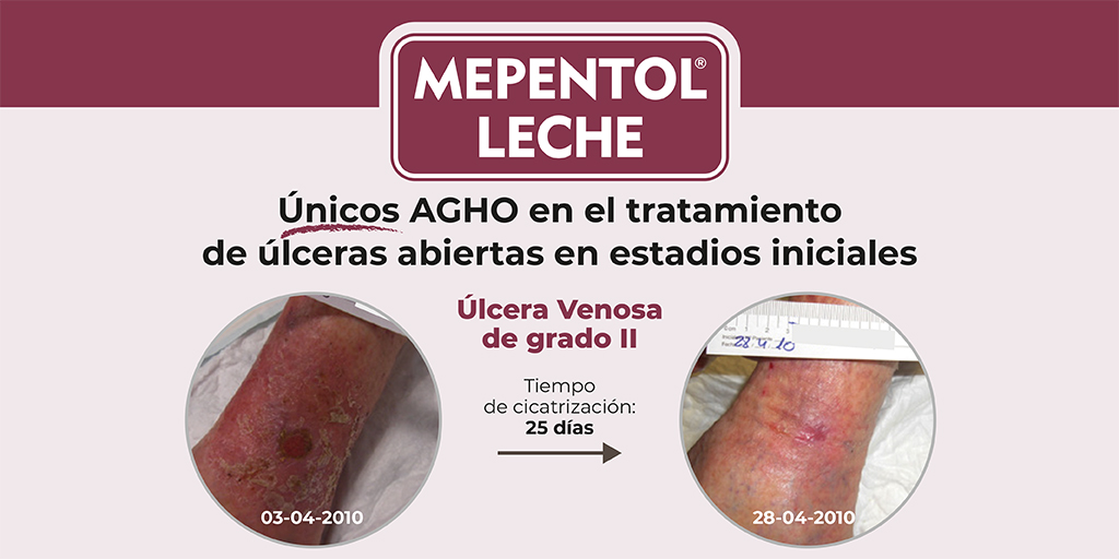 ULCERAS.NET on X: MEPENTOL & MEPENTOL LECHE son los únicos AGHO indicados  para el tratamiento de úlceras abiertas en estadios iniciales con un efecto  demostrado de cicatrización Visítanos en  #Alfasigma  #Mepentol #
