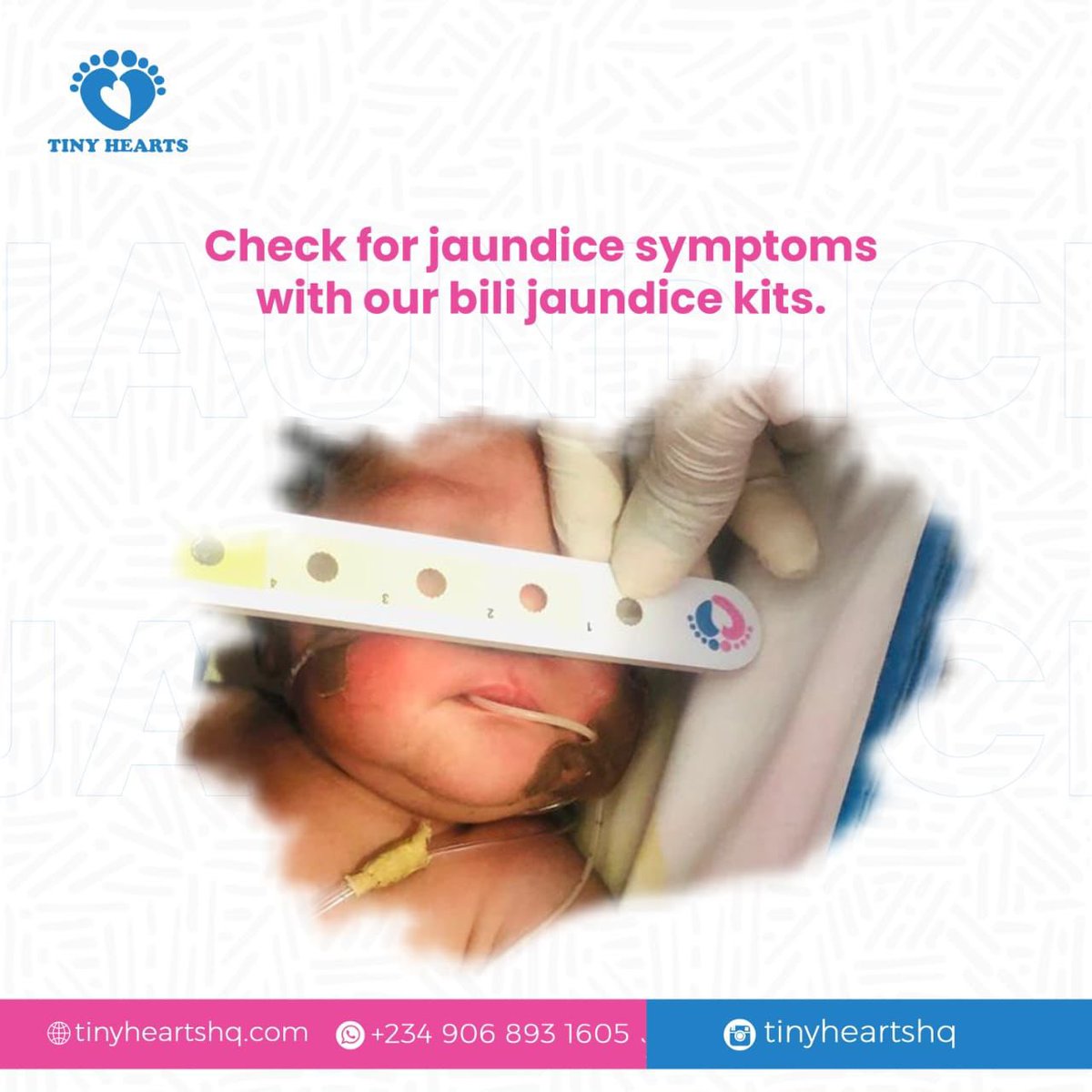 No more confusion! 
Check if your baby is jaundiced right at home! 
#infanthealth