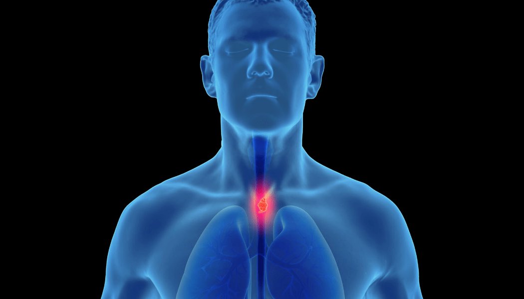 Thoracic Oman tweet media