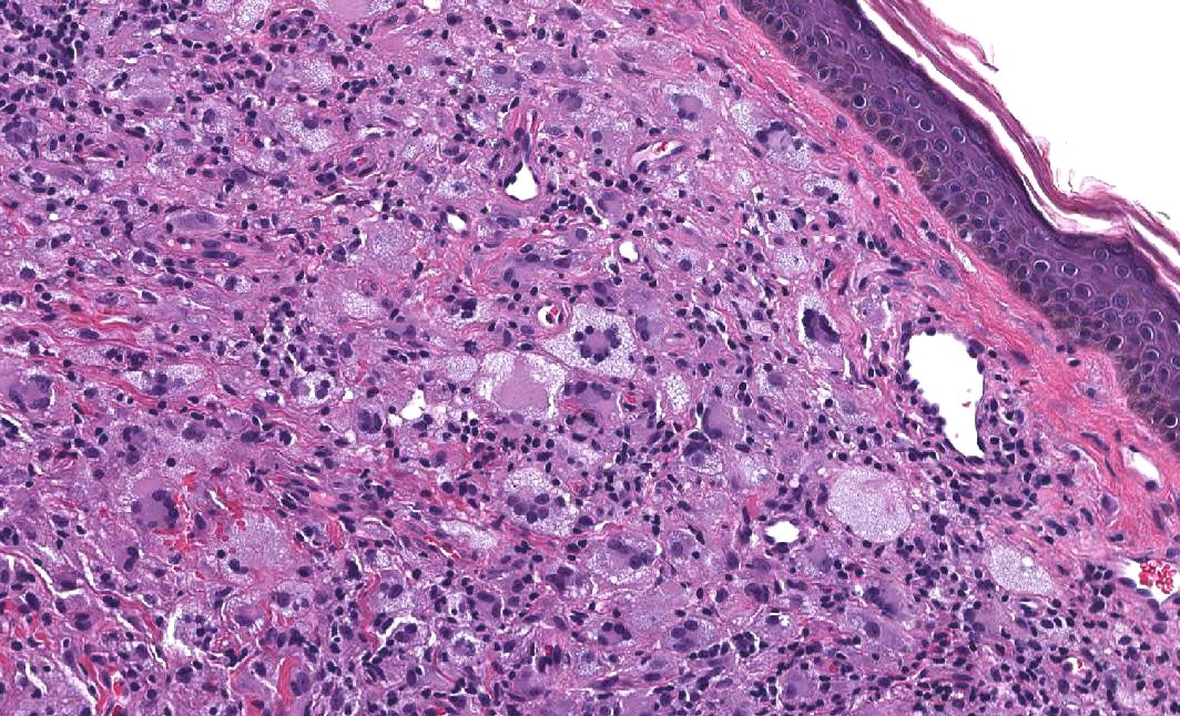Young person, head/neck. Not too tricky, just for fun! #dermpath #pathology #dermatology #dermtwitter