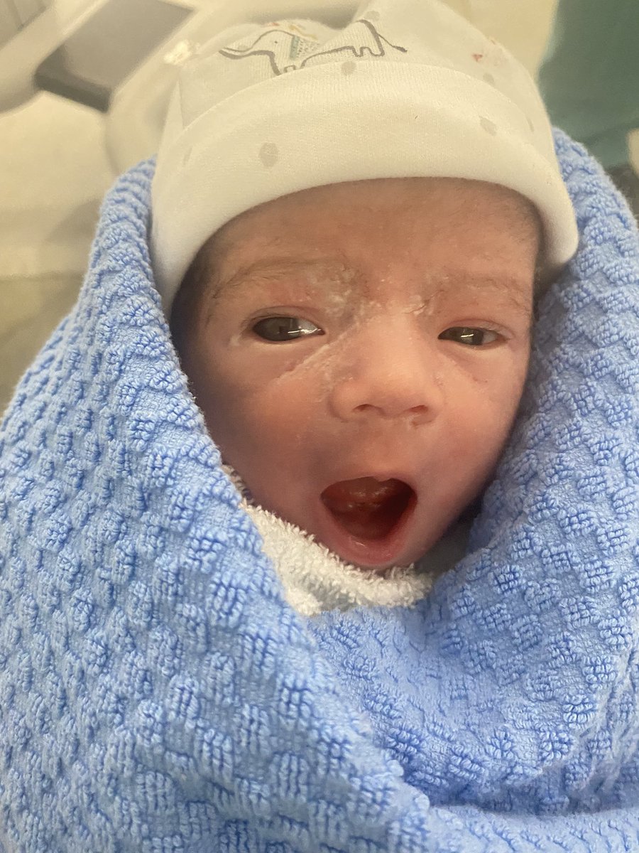 Rosemary_Murphy's tweet photo. Birth is birth. A caesarean birth isn’t better or worse than a vaginal birth-it’s just different.
Each experience is unique.
I’d do it all again tomorrow.
#CSectionAwarenessMonth
#positivecsection
#csectionmama
#forevergrateful https://t.co/fnA2jU8E2X