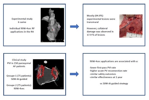 CircEP (@circulationep) on Twitter photo 90 vs 50-Watt Radiofrequency Applications for Pulmonary Vein Isolation: Experimental and Clinical Findings <a href="/fdanielramirez/">Dan Ramirez</a> <a href="/EloiMarijon/">Eloi Marijon, MD</a> #AHAJournals #Epeeps ahajournals.org/doi/10.1161/CI… 90 vs 50-Watt Radiofrequency Applications for Pulmonary Vein Isolation: Experimental and Clinical Findings <a href="/fdanielramirez/">Dan Ramirez</a> <a href="/EloiMarijon/">Eloi Marijon, MD</a> #AHAJournals #Epeeps ahajournals.org/doi/10.1161/CI…
