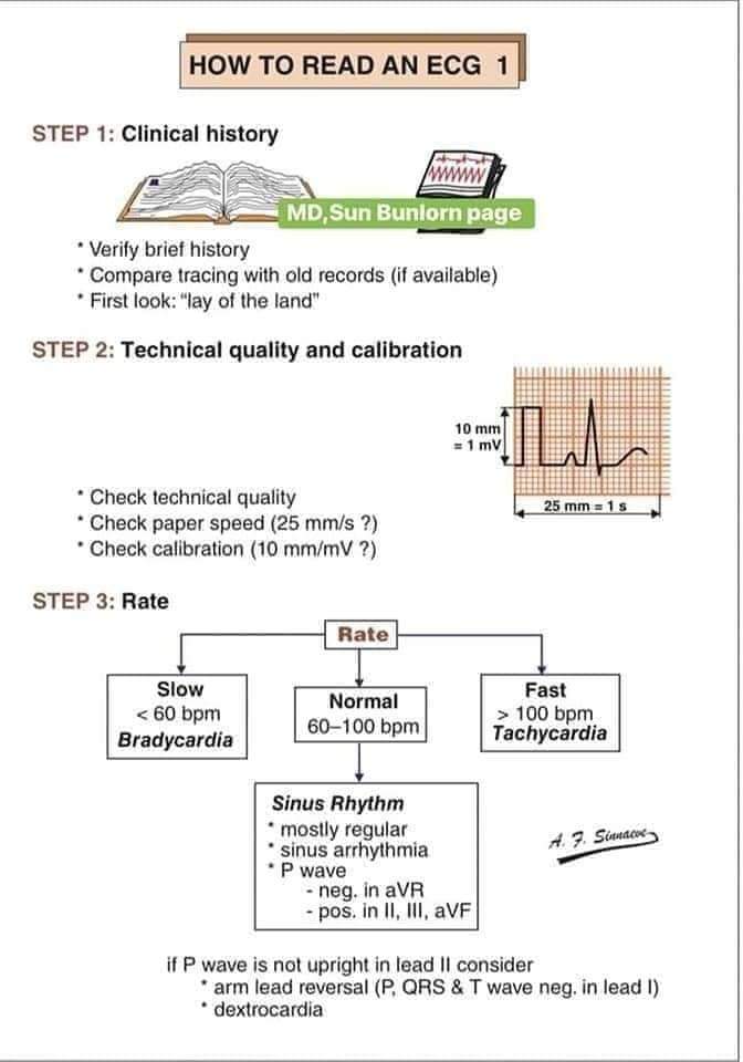 fazalabul's tweet photo. How to read an ECG https://t.co/Q2piLgnMTC