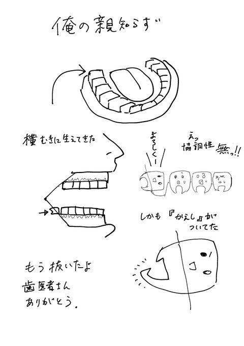 俺より厄介な親知らずおる〜? 