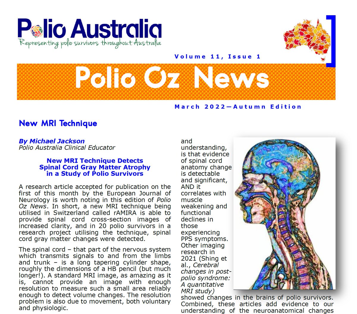 Our rAMIRA MRI technique is able to provide high quality spinal cord images in polio survivors:
polioaustralia.org.au/polio-oz-news-…
and bit.ly/3DSDBxa (Wendebourg JM, Weigel M et al.)