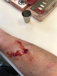 Lots of fun for the Sim Team last week practicing our moulage skills. With thanks to Paul from @SaviourMedical for a great day. @MDTGlobal