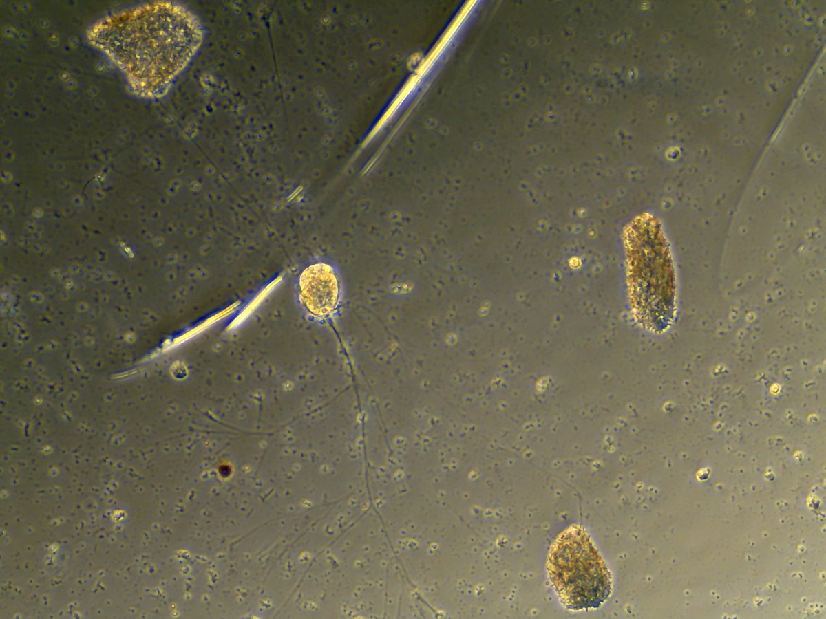 aralbright93's tweet photo. On today's episode of #FishtankFriday we have another Rhizarian (small yellow circle) and 3 large blobs that @BEuplotes and I think are actually Trichoplax!
These unassuming blobs are technically ANIMALS. (1/n) https://t.co/F7QMVCPr0T