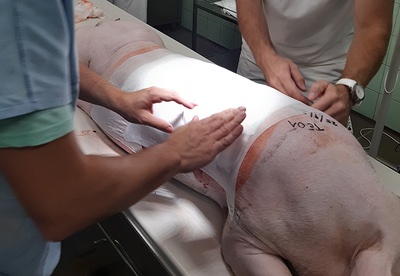 MENDELUcz's tweet photo. Vědci z #mendelu testovali nové hojivé náplasti s nanočásticemi rybího oleje. Nové složení náplastí v některých případech fungovalo lépe než u běžných postupů. Na výzkumu spolupracovali s @CEITEC_Brno @VUTvBrne @FNUSA https://t.co/Hp3oqWhWXO https://t.co/nx4ck9pall